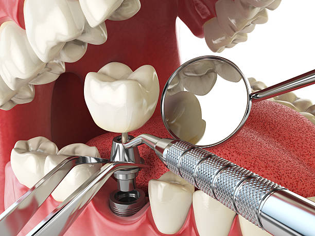 Best Urgent Dental Care  in Jamestown, TN